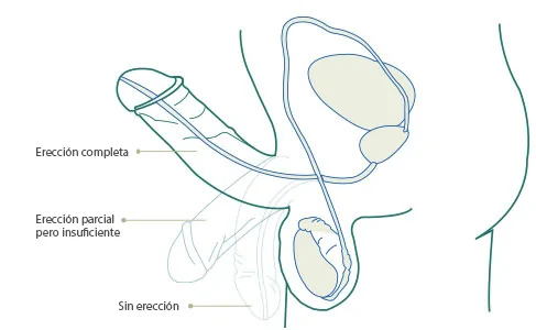 penis drawing